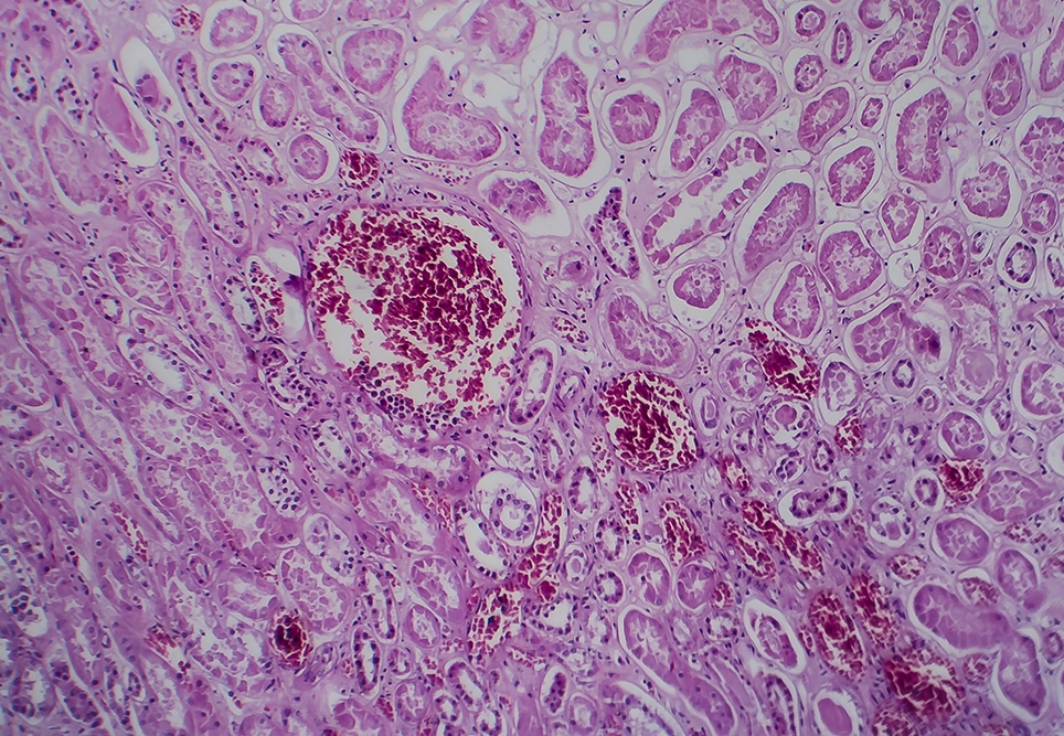 APSGN 964x667 Landscape